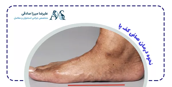 نحوه درمان صافی کف پا