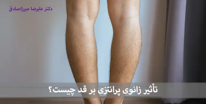 تأثیر زانوی پرانتزی بر قد چیست؟