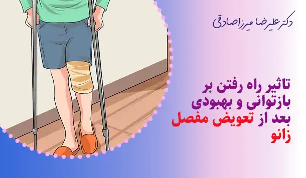 تاثیر راه رفتن بر بازتوانی و بهبودی بعد از تعویض مفصل زانو
