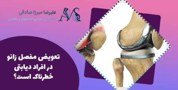 تعویض مفصل زانو در افراد دیابتی خطرناک است؟