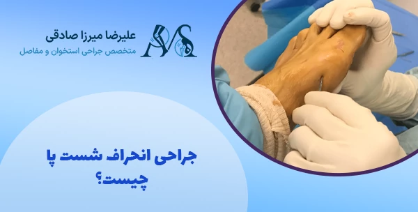 جراحی انحراف شست پا چیست؟