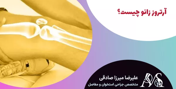 آرتروز زانو چیست؟