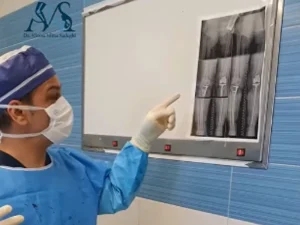 بهترین جراح زانو در سعادت آباد