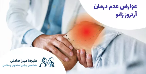 عوارض عدم درمان آرتروز زانو