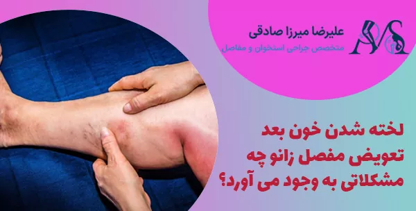 لخته شدن خون بعد تعویض مفصل زانو چه مشکلاتی به وجود می آورد؟