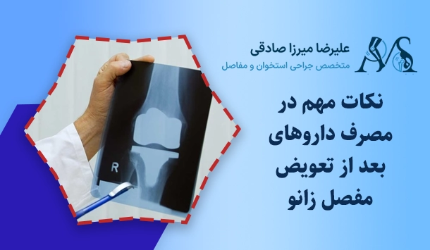 نکات مهم در مصرف داروهای بعد از تعویض مفصل زانو