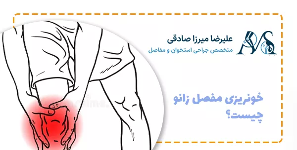 خونریزی مفصل زانو چیست؟
