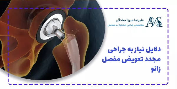 دلایل نیاز به جراحی مجدد تعویض مفصل زانو