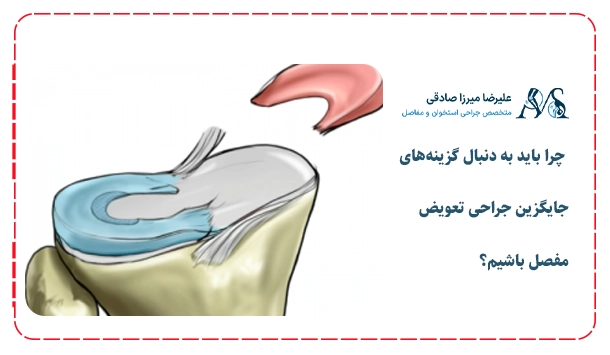  چرا باید به دنبال گزینه‌های جایگزین جراحی تعویض مفصل باشیم؟