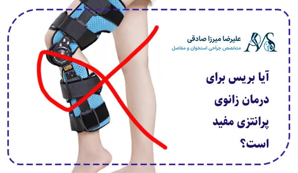 آیا بریس برای درمان زانوی پرانتزی مفید است؟