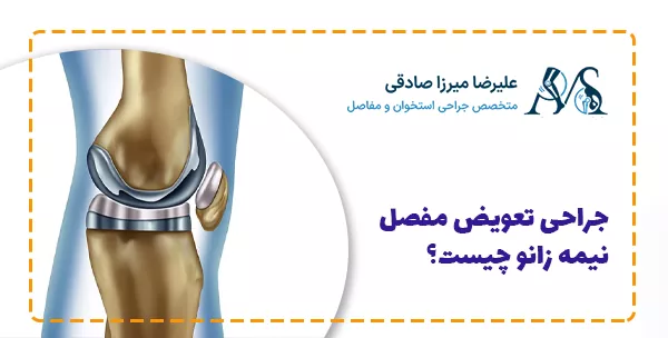 جراحی تعویض مفصل نیمه زانو چیست؟