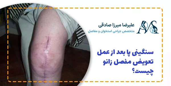 سنگینی پا بعد از عمل تعویض مفصل زانو چیست؟