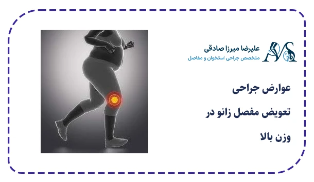 عوارض جراحی تعویض مفصل زانو در وزن بالا