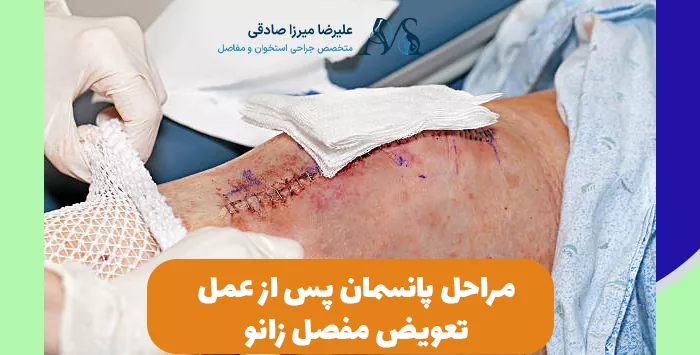 مراحل پانسمان پس از عمل تعویض مفصل زانو