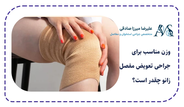 وزن مناسب برای جراحی تعویض مفصل زانو چقدر است؟
