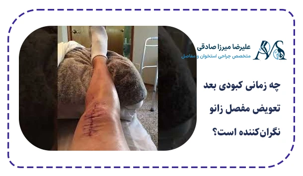 چه زمانی کبودی بعد تعویض مفصل زانو نگران‌کننده است؟