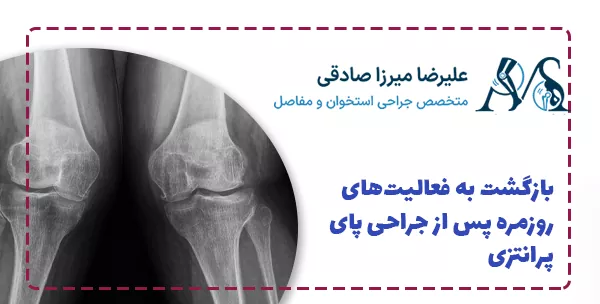 بازگشت به فعالیت‌های روزمره پس از جراحی پای پرانتزی