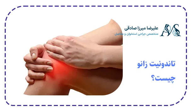 تاندونیت زانو چیست؟