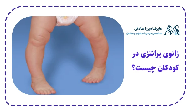 زانوی پرانتزی در کودکان چیست؟