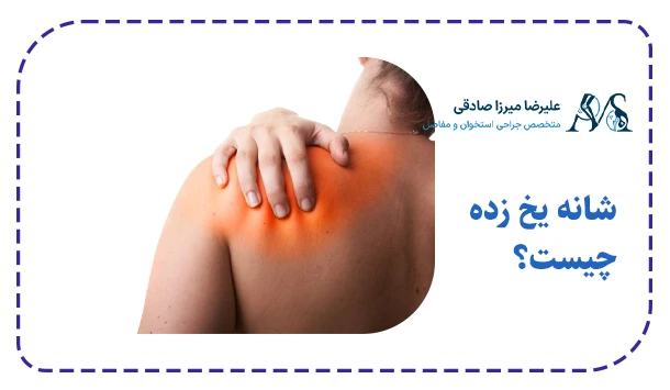 شانه یخ زده چیست؟