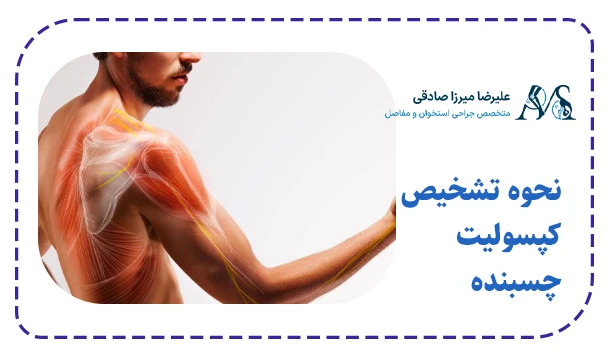 نحوه تشخیص کپسولیت چسبنده 