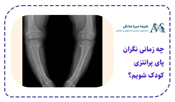 چه زمانی نگران پای پرانتزی کودک شویم؟