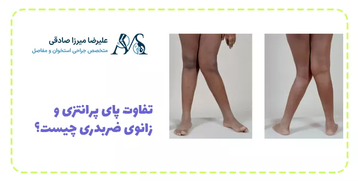 تفاوت پای پرانتزی و زانوی ضربدری چیست؟