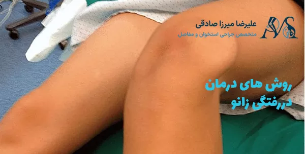 روش های درمان دررفتگی زانو