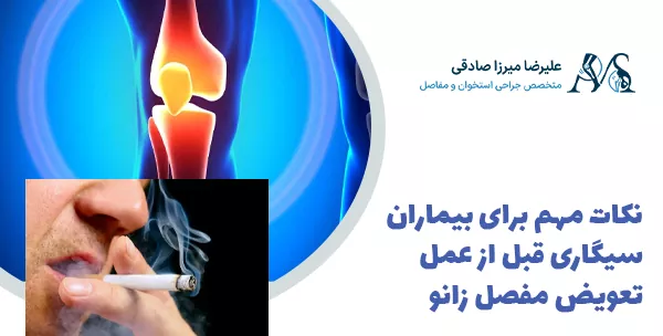 نکات مهم برای بیماران سیگاری قبل از عمل تعویض مفصل زانو