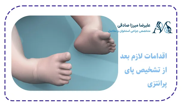 اقدامات لازم بعد از تشخیص پای پرانتزی