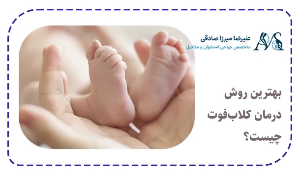 بهترین روش درمان کلاب‌فوت چیست؟