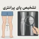 تشخیص پای پرانتزی