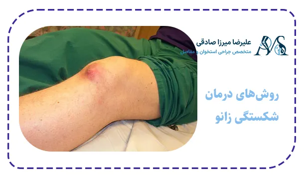 روش‌های درمان شکستگی زانو