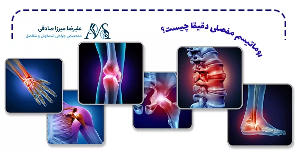 روماتیسم مفصلی دقیقا چیست؟