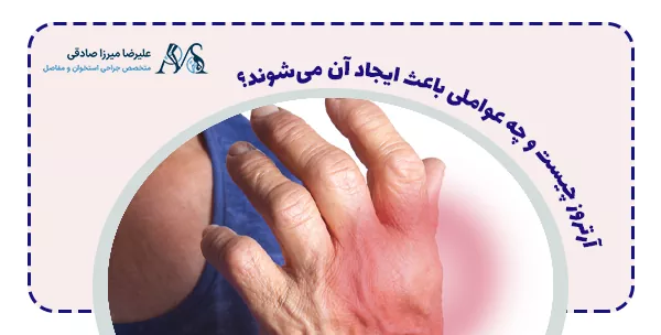 آرتروز چیست و چه عواملی باعث ایجاد آن می‌شوند؟