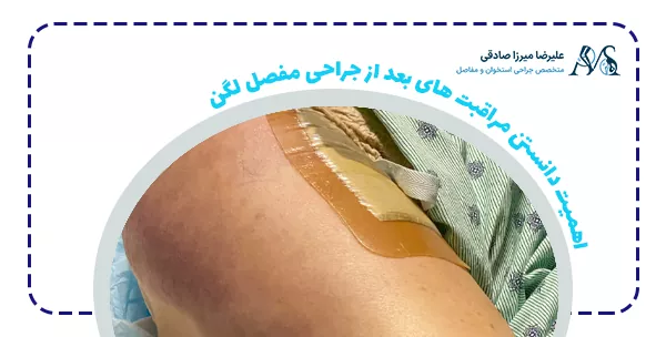 اهمیت دانستن مراقبت های بعد از جراحی مفصل لگن