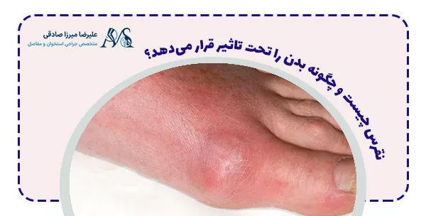 نقرس چیست و چگونه بدن را تحت تاثیر قرار می‌دهد؟