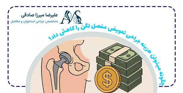 چگونه میتوان هزینه‌ جراحی تعویض‌ مفصل‌ لگن را کاهش داد؟