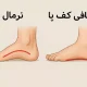 جراحی صافی کف پا