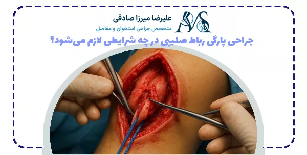جراحی پارگی رباط صلیبی در چه شرایطی لازم می‌شود؟
