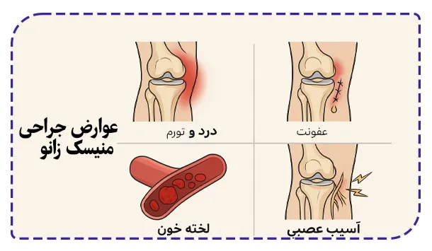 عوارض جراحی
منیسک زانو
