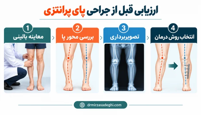 مراحل ارزیابی قبل از جراحی پای پرانتزی