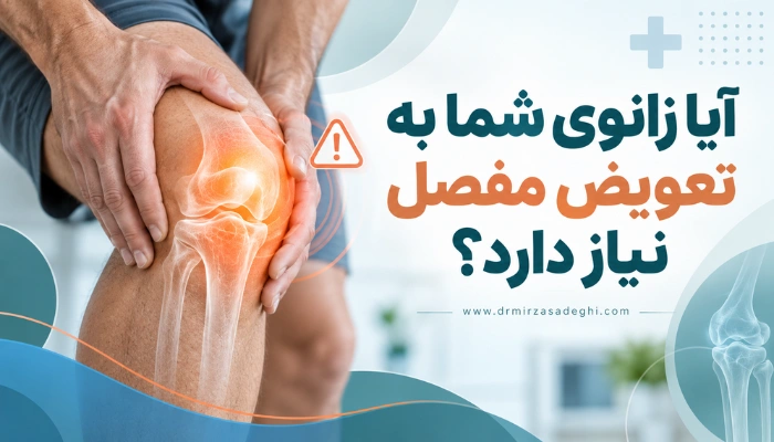 آیا زانوی شما به تعویض مفصل نیاز دارد؟